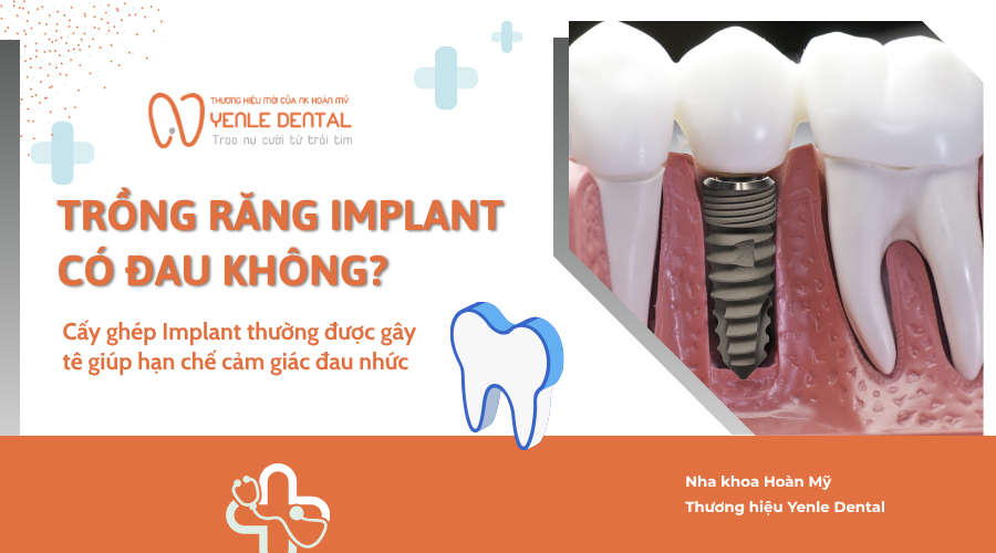 trồng răng implant